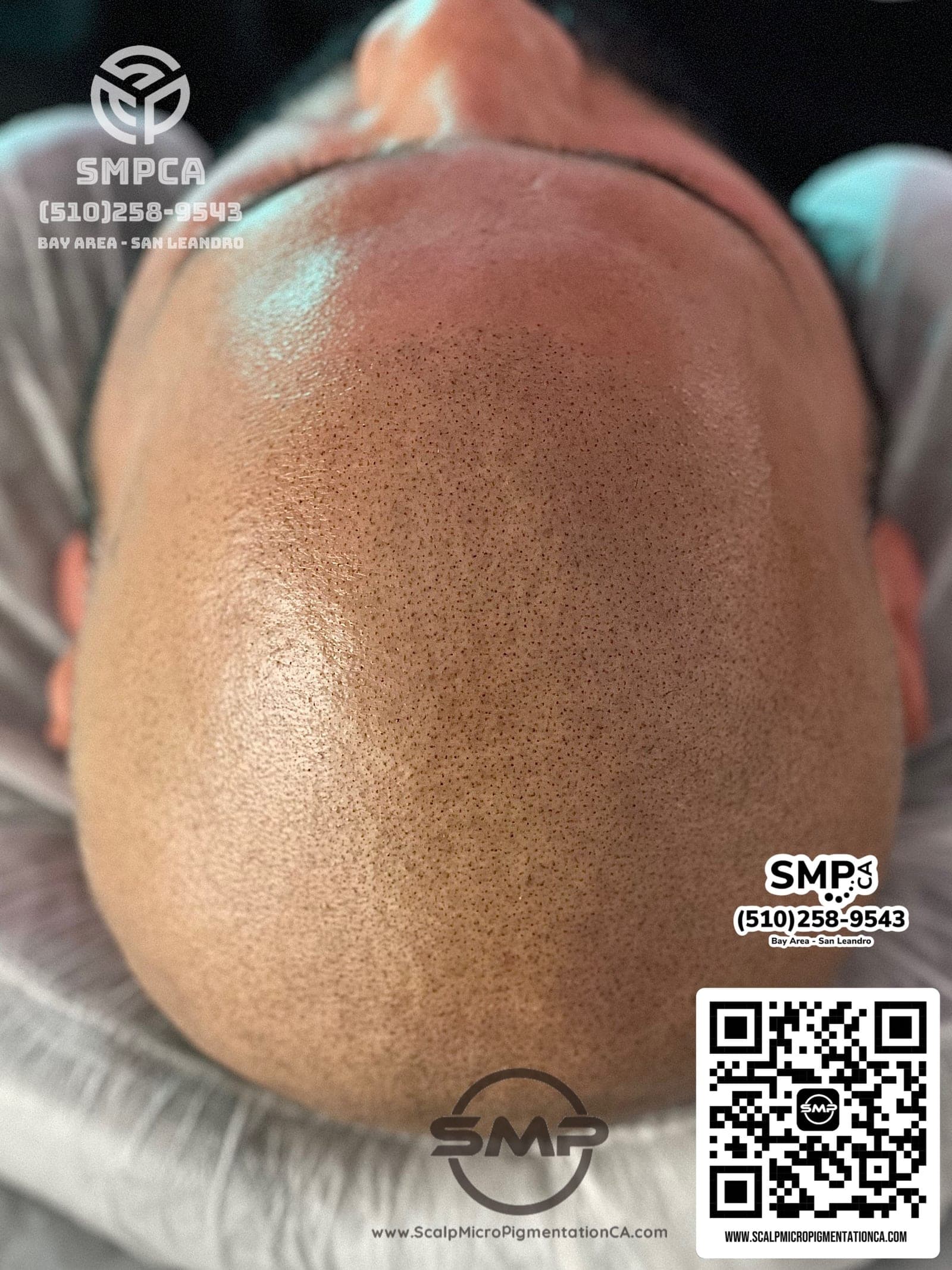 Scalp micropigmentation result for a San Ramon client by SMPCA