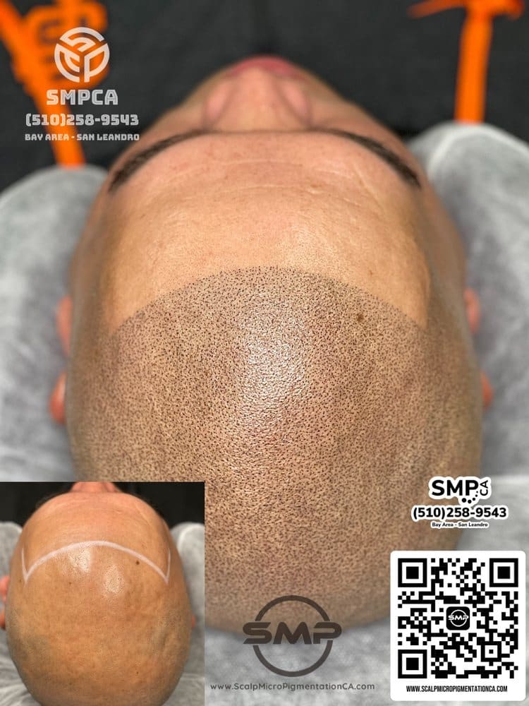SMPCA scalp micropigmentation transformation 9 by Joe V. Nguyen, San Lorenzo CA