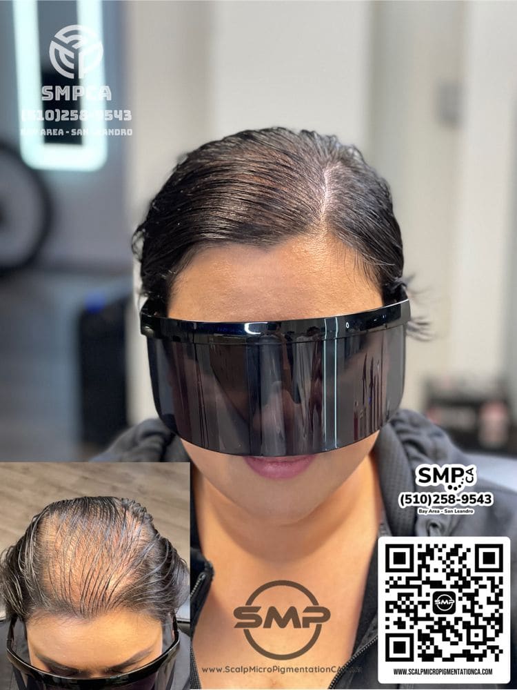 SMPCA scalp micropigmentation transformation 11 by Joe V. Nguyen, San Lorenzo CA