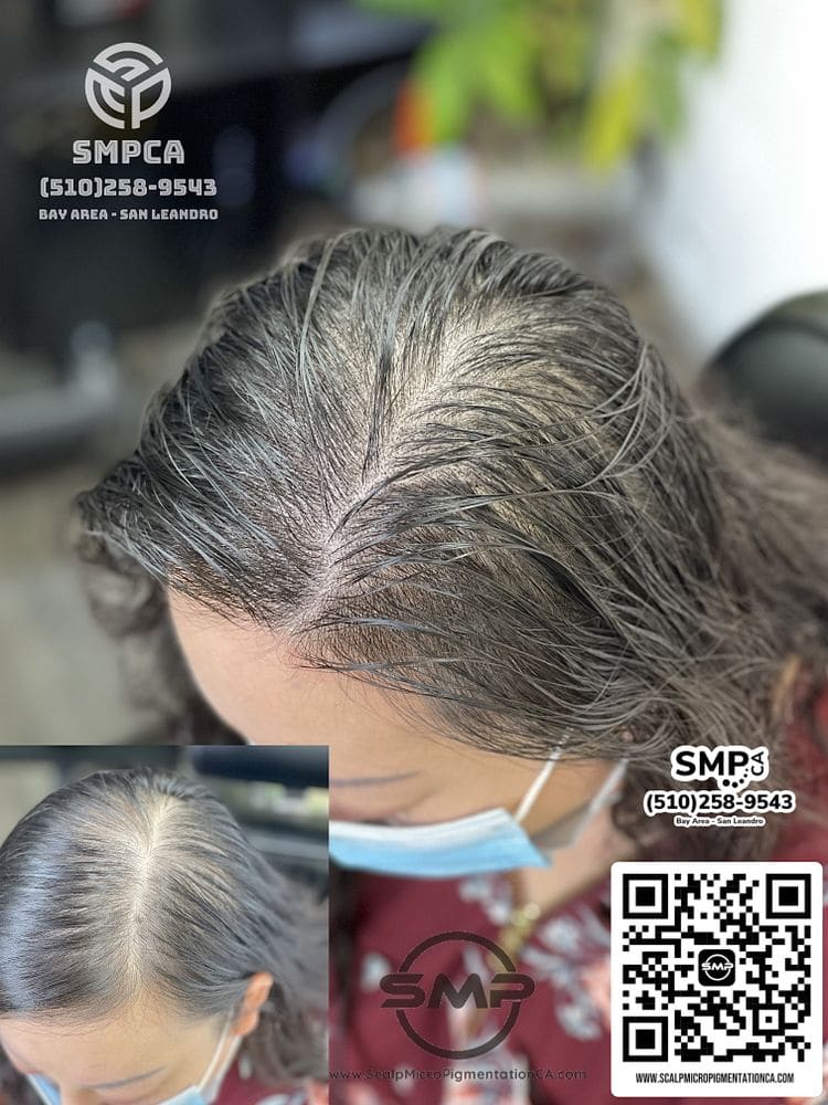 SMPCA scalp micropigmentation transformation 32 by Joe V. Nguyen, San Lorenzo CA