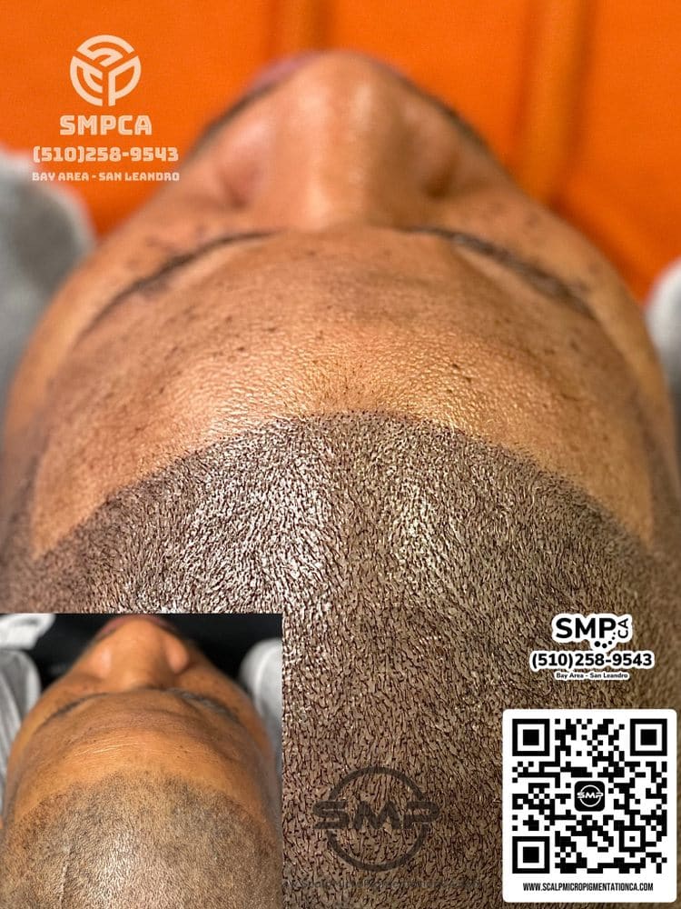 SMPCA scalp micropigmentation transformation 44 by Joe V. Nguyen, San Lorenzo CA