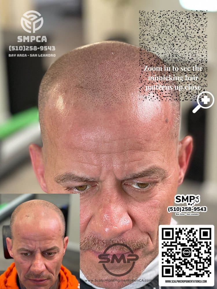 SMPCA scalp micropigmentation transformation 52 by Joe V. Nguyen, San Lorenzo CA