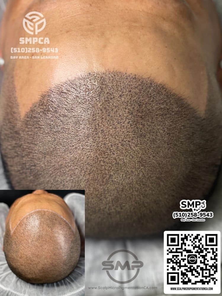 SMPCA scalp micropigmentation transformation 54 by Joe V. Nguyen, San Lorenzo CA