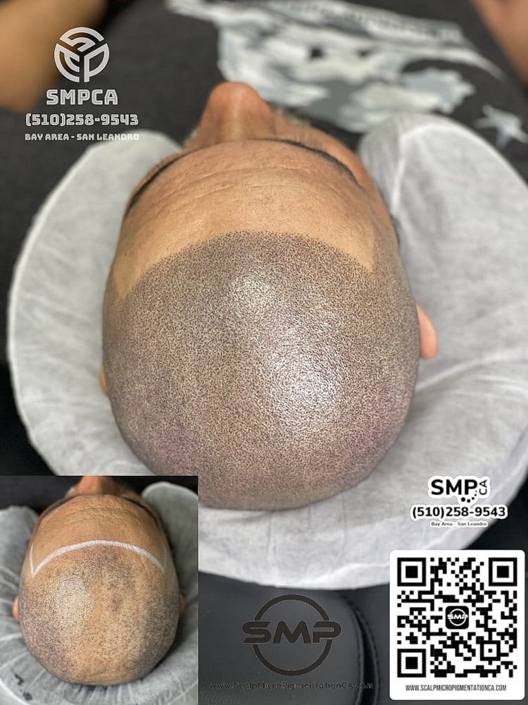 SMPCA scalp micropigmentation transformation 55 by Joe V. Nguyen, San Lorenzo CA