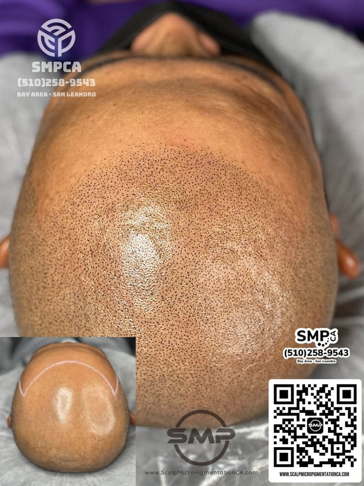 SMPCA scalp micropigmentation transformation 58 by Joe V. Nguyen, San Lorenzo CA