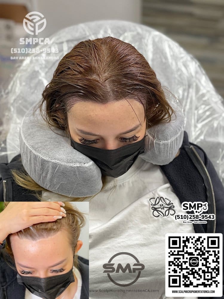 SMPCA scalp micropigmentation transformation 64 by Joe V. Nguyen, San Lorenzo CA