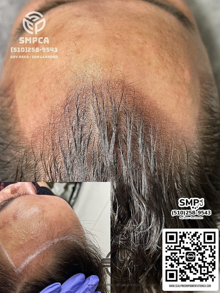 SMPCA scalp micropigmentation transformation 70 by Joe V. Nguyen, San Lorenzo CA