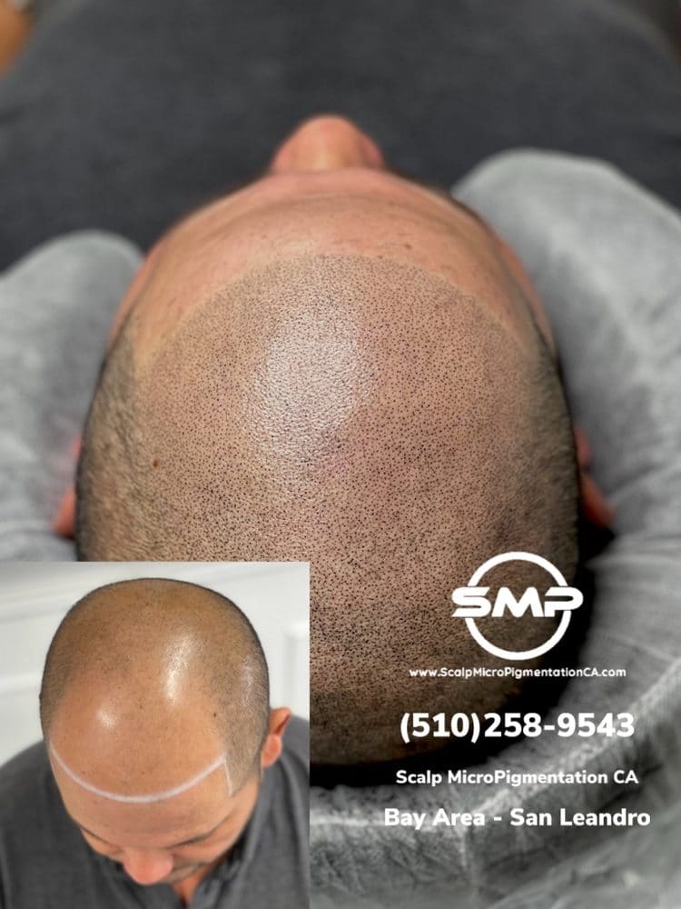 SMPCA scalp micropigmentation transformation 74 by Joe V. Nguyen, San Lorenzo CA